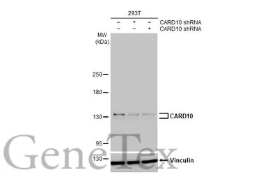 CARD10 antibody [HL2261]