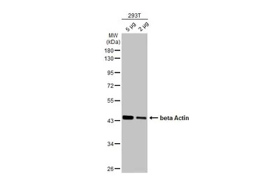 beta Actin antibody [HL1927]