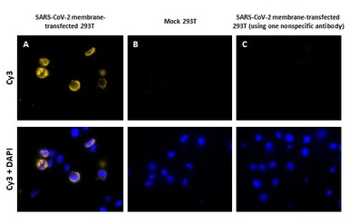 SARS-CoV-2 Membrane Protein Proximity Ligation Assay (PLA) Kit (Cy3)
