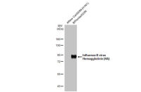 Influenza B virus Hemagglutinin (HA) antibody [HL2208]