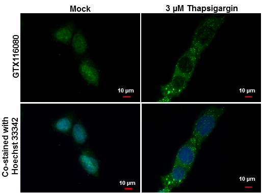 LC3B antibody [N1C3]