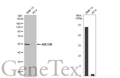 ARL13B antibody [HL2173]