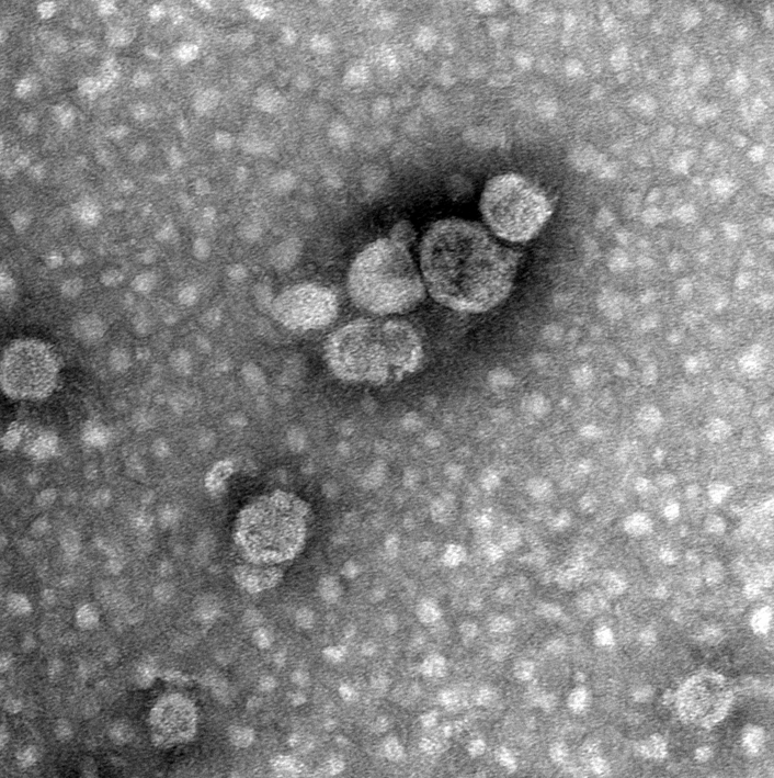 强势来袭-国自然热点[外泌体研究解决方案]