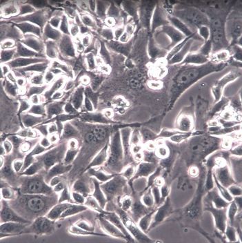 【Anglne】Anglne细胞/Anglne细胞/Anglne人卵巢癌细胞