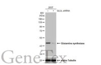 Glutamine synthetase antibody [HL2283]