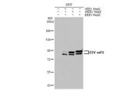 Equine Encephalitis Virus nsP2 antibody [HL1920]