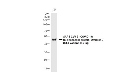 SARS-CoV-2 (COVID-19) Nucleocapsid protein, Omicron / BQ.1 variant, His tag