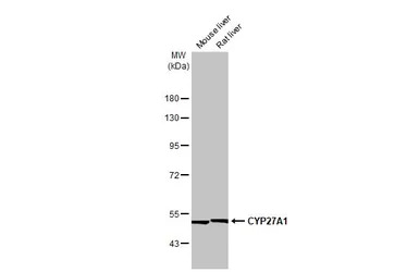 CYP27A1 antibody [HL1820]