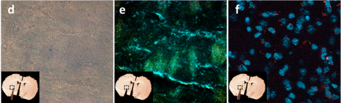 强势来袭-国自然热点[外泌体研究解决方案]
