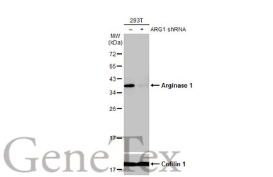Arginase 1 antibody [HL1891]