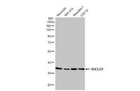 SUCLG1 antibody [HL2387]