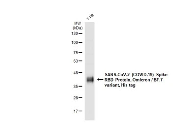 SARS-CoV-2 (COVID-19) Spike RBD Protein, Omicron / BF.7 variant, His tag