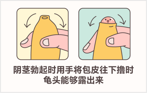 孩子啥时候割包皮，注意事项有哪些？