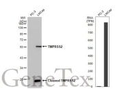 TMPRSS2 antibody [HL2279]