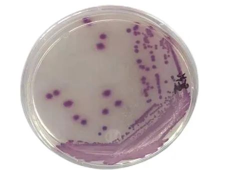 啤酒检测中常见的微生物菌落形态