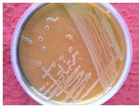 啤酒检测中常见的微生物菌落形态