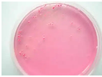 啤酒检测中常见的微生物菌落形态