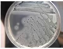 啤酒检测中常见的微生物菌落形态