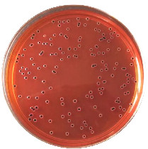 啤酒检测中常见的微生物菌落形态