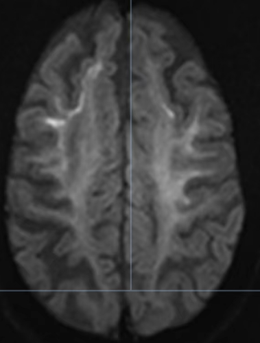 要花 5 年才能确诊的怪病？这个团队凭一张影像，不到一周就破案