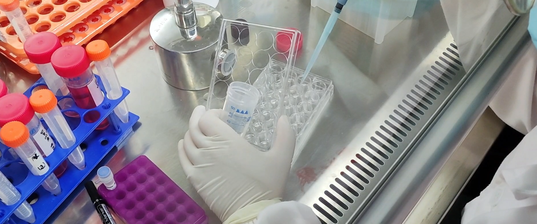 实操详解丨贴壁细胞的培养方法④细胞复苏