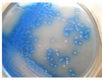 啤酒检测中常见的微生物菌落形态