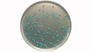 啤酒检测中常见的微生物菌落形态