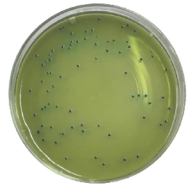 啤酒检测中常见的微生物菌落形态