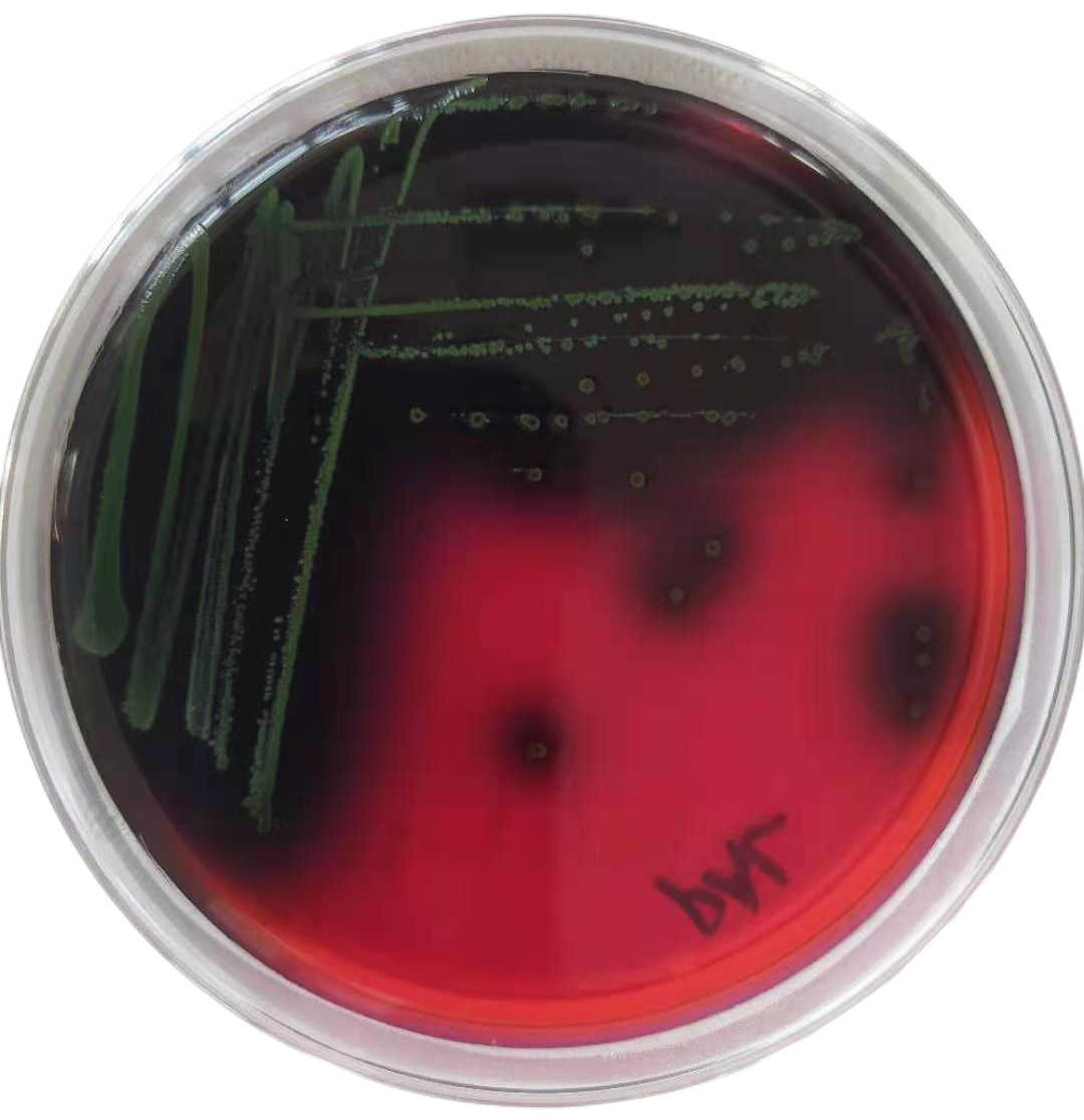 啤酒检测中常见的微生物菌落形态