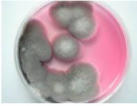 啤酒检测中常见的微生物菌落形态