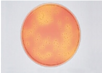 啤酒检测中常见的微生物菌落形态