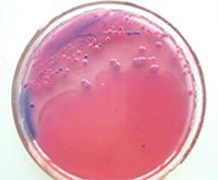 啤酒检测中常见的微生物菌落形态