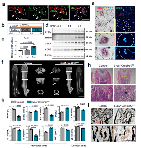 NAT COMMUN IF>17丨BRD9介导的染色质重塑抑制破骨细胞的发生