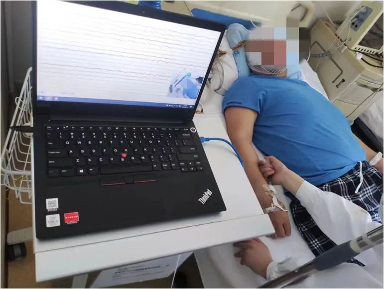 没有抽搐也能称为癫痫发作?