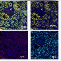 六色多重免疫组化试剂盒