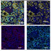 多色免疫组化试剂盒