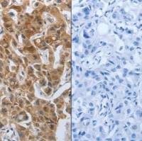 免疫组化（IHC）