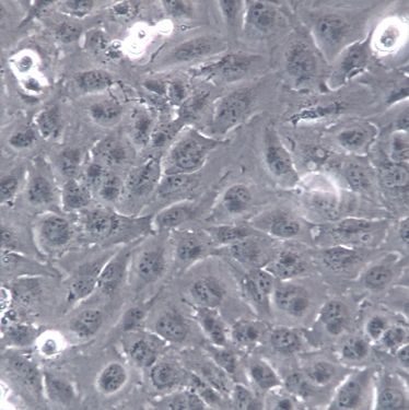 【Daoy】Daoy细胞/Daoy细胞/Daoy人髓母细胞瘤细胞