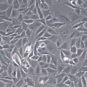 【SAOS-2】SAOS-2细胞/SAOS-2细胞/SAOS-2人成骨肉瘤细胞