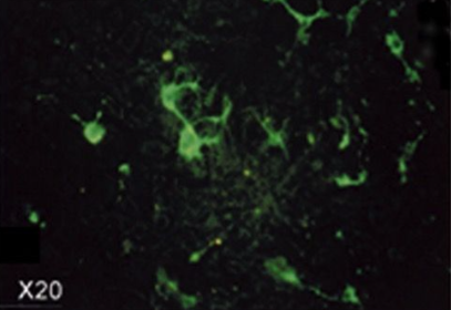 艾美捷Claudin-11抗体中英文说明