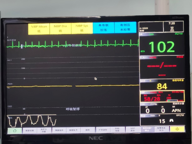 广西中医药大学第一附属医院成功救治一位肝硬化门静脉高压伴消化道大出血休克患者