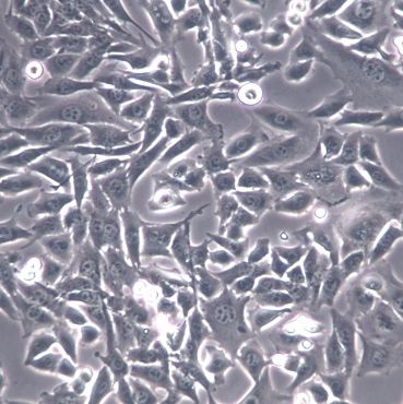 【MOVAS】MOVAS细胞/MOVAS细胞/MOVAS小鼠主动脉血管平滑肌细胞