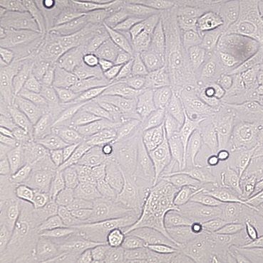 【SiHa】SiHa细胞/SiHa细胞/SiHa人子宫颈鳞癌细胞
