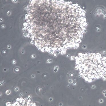 【NK-92MI】NK-92MI细胞/NK-92MI细胞/NK-92MI人恶性非霍奇金淋巴瘤患者的自然杀伤细胞