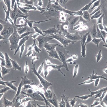 【DCS】DCS细胞/DCS细胞/DCS小鼠树突状肉瘤细胞