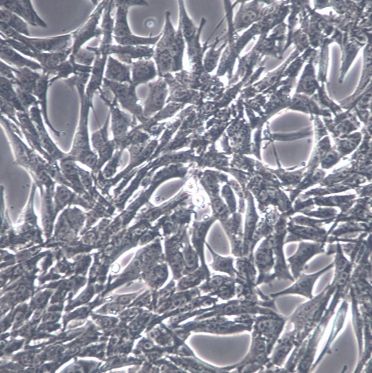 pan02小鼠胰腺癌细胞
