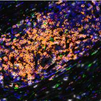 多重免疫组化染色（mIHC）
