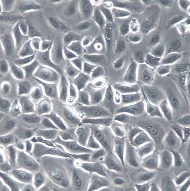 【RWPE-2】RWPE-2细胞/RWPE-2细胞/RWPE-2人前列腺正常细胞