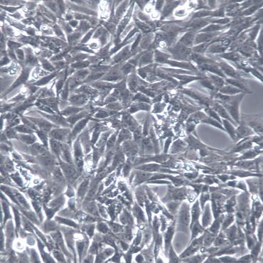 HSC-T6大鼠肝星状细胞