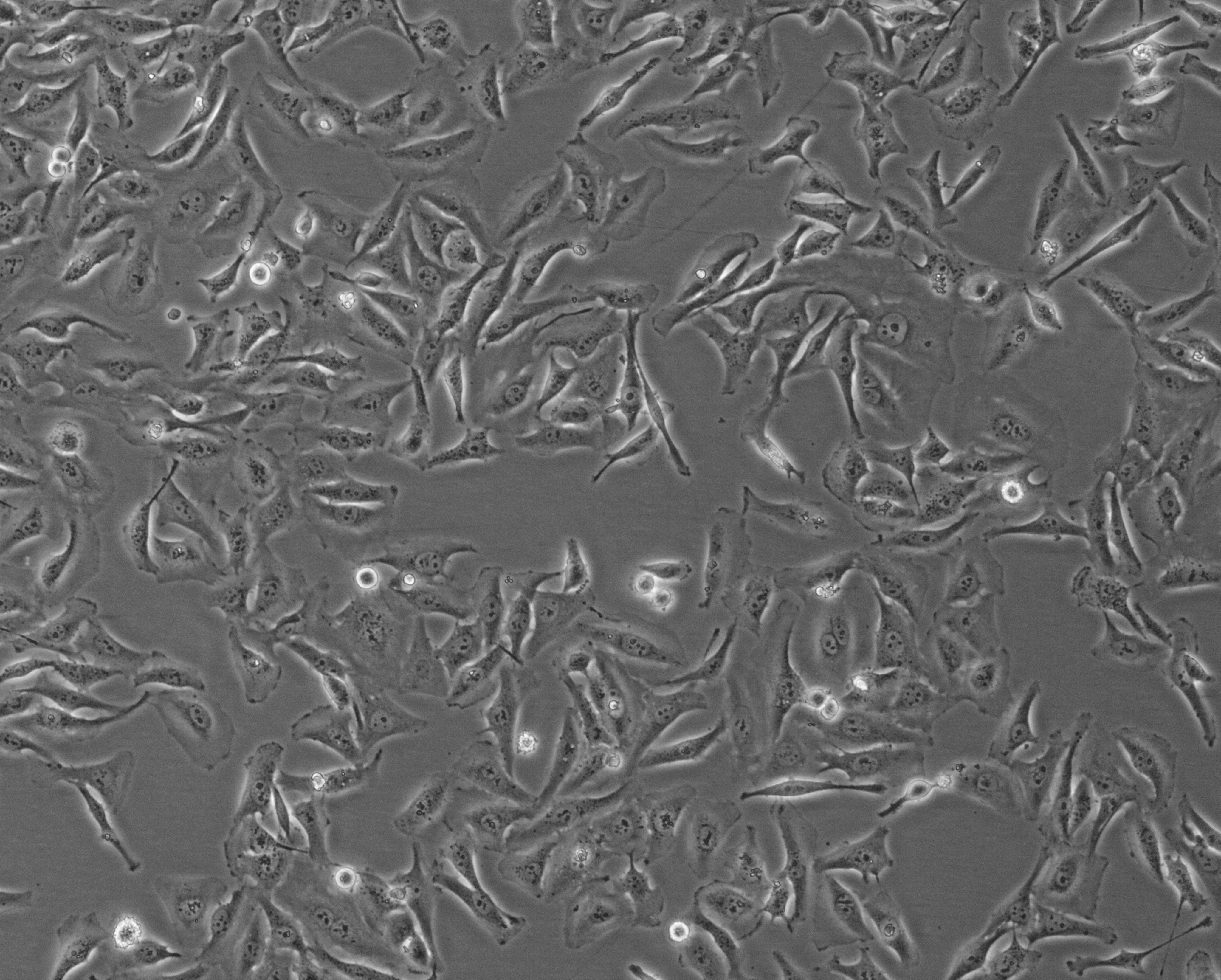 细胞攻略 | HeLa(人宫颈癌细胞)细胞培养教程